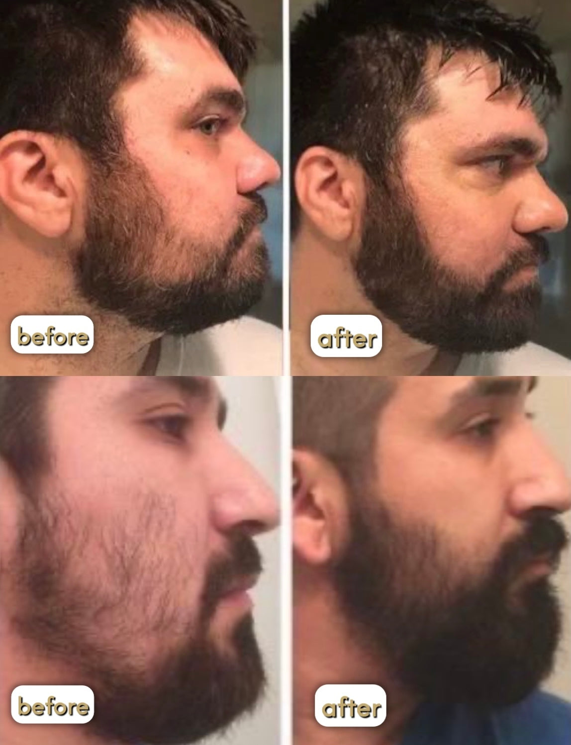 Folvo Beard Enhancer